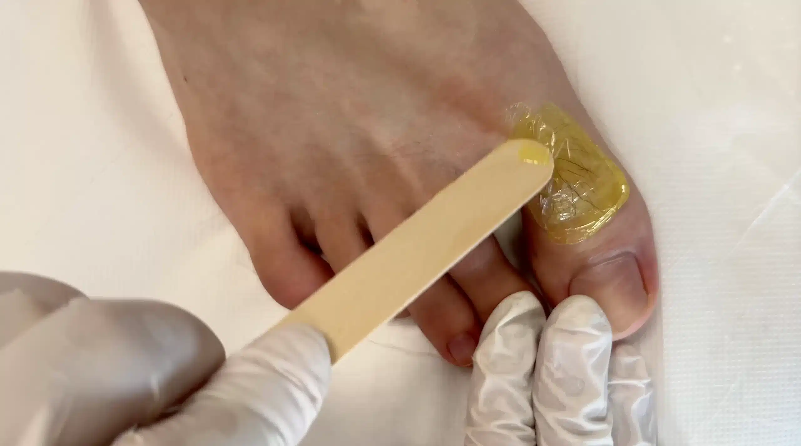 Depilazione ginocchia e alluci